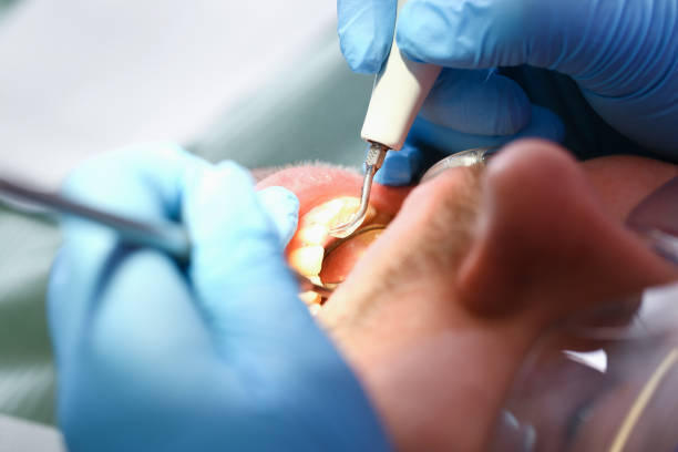 Professional Emergency Dental Service in OK