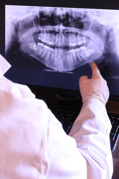 Best Dental Abscess Treatment in Cashion, OK